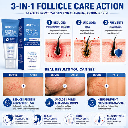 LIMETOW® Botanical Folliculitis Care Cream