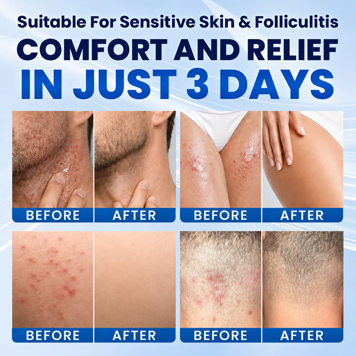 LIMETOW® Botanical Folliculitis Care Cream